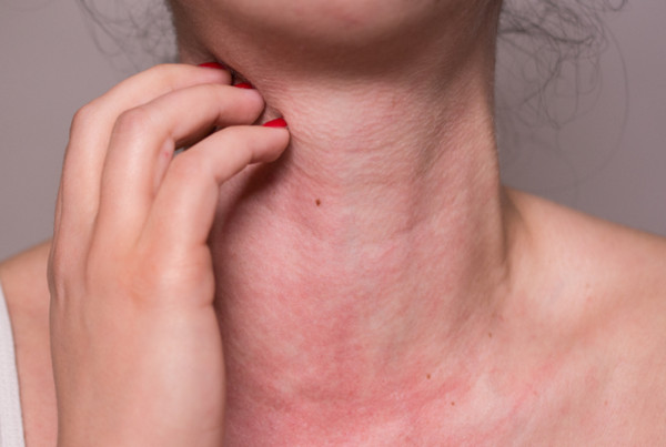 Dị ứng thời tiết: Nguyên nhân, biểu hiện và cách xử lý an toàn, hiệu quả