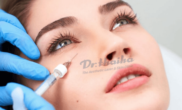 Danh sách các loại filler được Bộ y tế cấp phép nhập khẩu và lưu hành