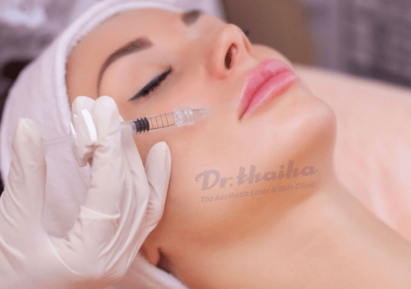 Filler tạm thời là gì? Các loại filler được sử dụng trong thẩm mỹ