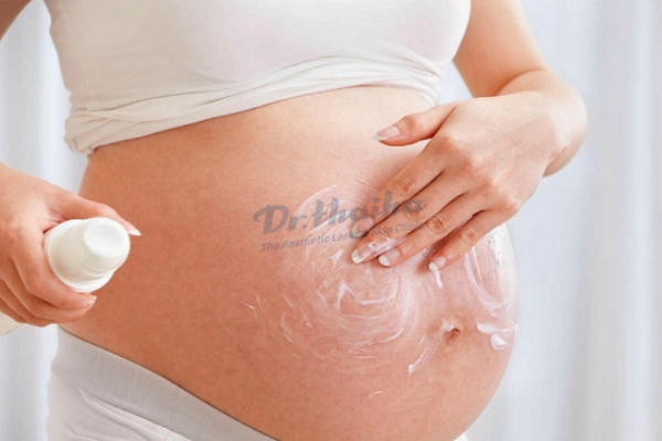 Bí quyết chống rạn da bụng khi mang thai siêu hiệu quả