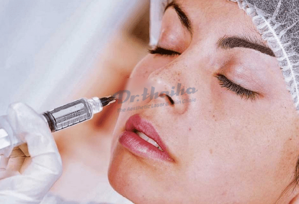 Hỏi đáp: Sau khi tiêm filler mũi cần làm gì mới tốt nhất?