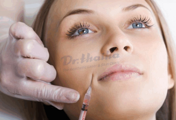 Tiêm botox rãnh cười là gì? Phòng khám Da liễu thẩm mỹ Bác sỹ Thái Hà