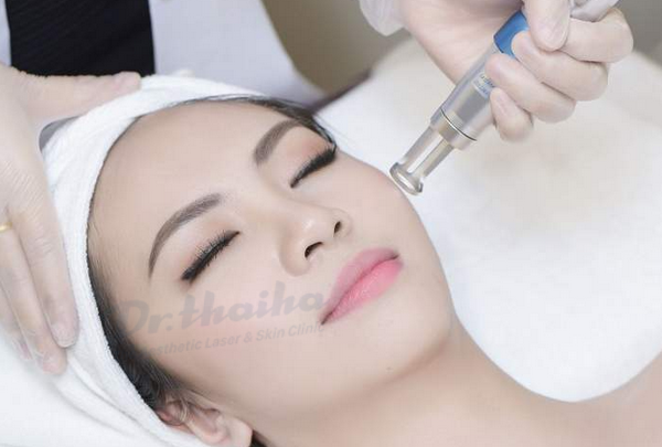 Điều trị tàn nhang chi phí hết bao nhiêu? Bảng giá mới nhất