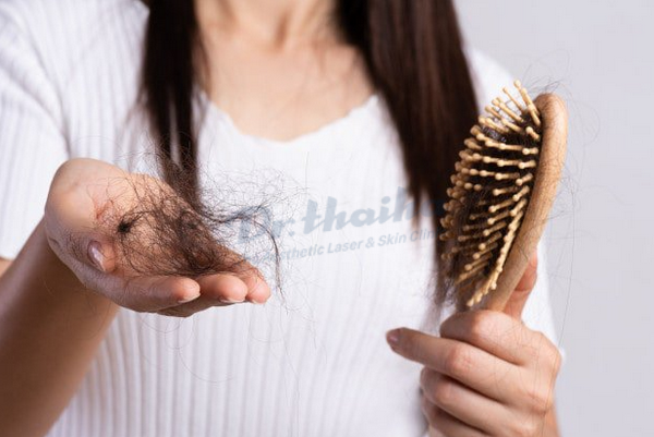Rụng tóc thiếu chất gì? Chuyên gia phòng khám chia sẻ