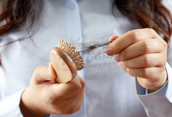 Rụng tóc thiếu chất gì? Chuyên gia phòng khám chia sẻ