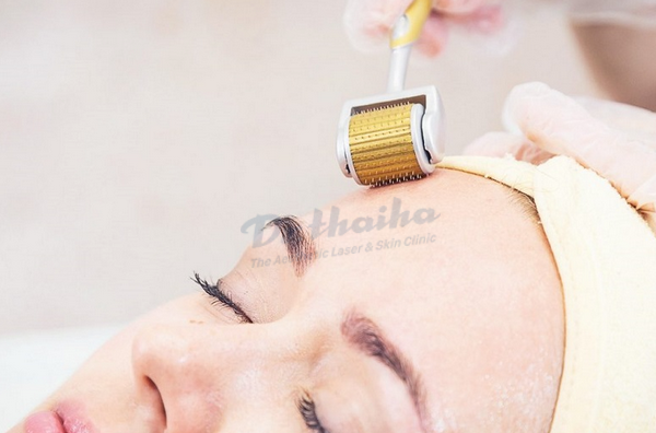Cách phân biệt lỗ chân lông to và sẹo rỗ cho chị em