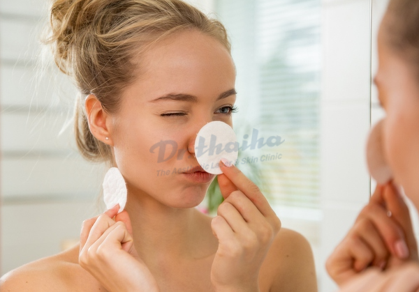 Trị mụn 1 tuần có khỏi được không? Chia sẻ từ chuyên gia