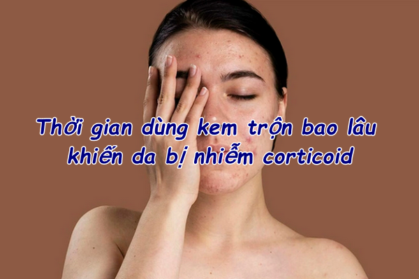 Hỏi đáp: Thời gian dùng kem trộn bao lâu bị nhiễm corticoid