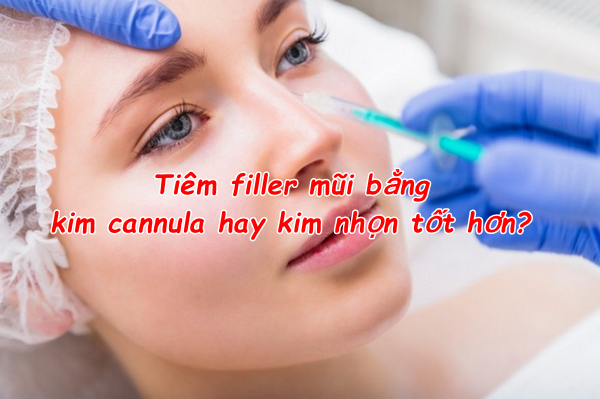 Hỏi đáp: Tiêm filler mũi bằng kim cannula hay kim nhọn tốt hơn?