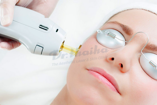 So sánh laser trẻ hóa và các phương pháp khác