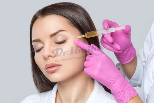 Tiêm filler tan quầng thâm mắt là gì, có hiệu quả không?