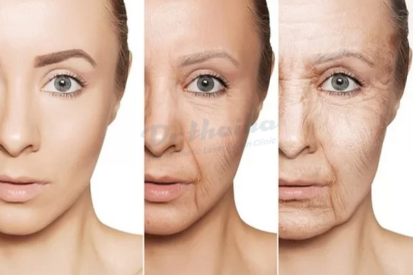 Trẻ hóa toàn năng Shining Facelift: Những thông tin bạn cần bạn cần biết