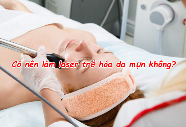 Hỏi đáp: Có nên làm laser trẻ hóa da mụn không?