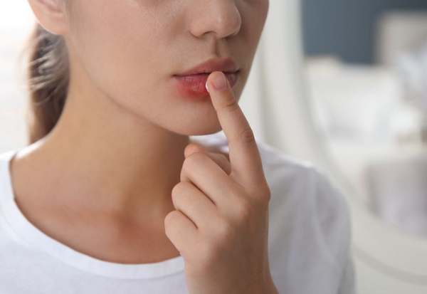 Xỏ khuyên bị sẹo lồi môi phải làm sao? 