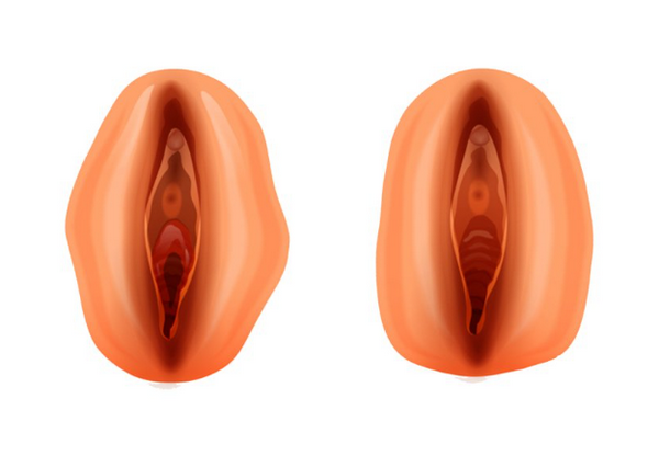 Tiêm filler làm đầy vùng kín được không? Có nguy hiểm không? Bác sĩ giải đáp