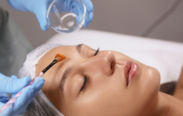 Cách làm peel da nhanh bong là gì? Cần lưu ý gì