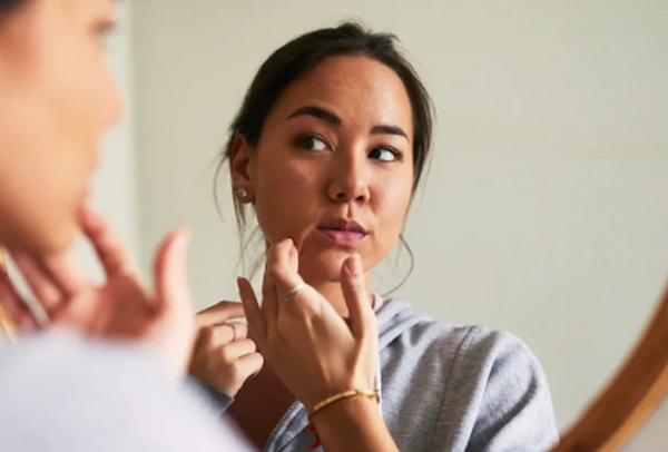 Hỏi đáp: Bôi serum bị nổi mụn do đâu