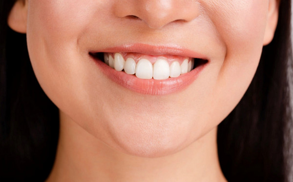 Cười không tự nhiên sau khi tiêm botox do đâu? Có tự cải thiện không