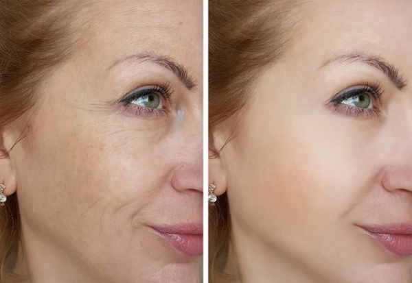 Da khoẻ đẹp là thế nào? Làm cách nào để da khỏe đẹp mỗi ngày