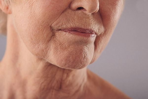 Da mặt chảy xệ và cách làm căng da mặt tự nhiên