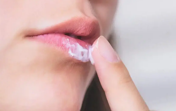 Hỏi đáp: Phun môi nổi mụn nước là bị làm sao?