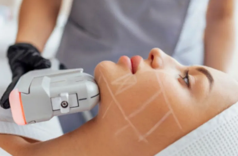 Ngấn cổ là gì? Cách giảm ngấn cổ an toàn và hiệu quả