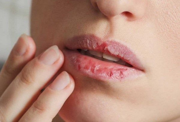 Xóa xăm môi tại nhà như thế nào? Cách nào hiệu quả nhất?