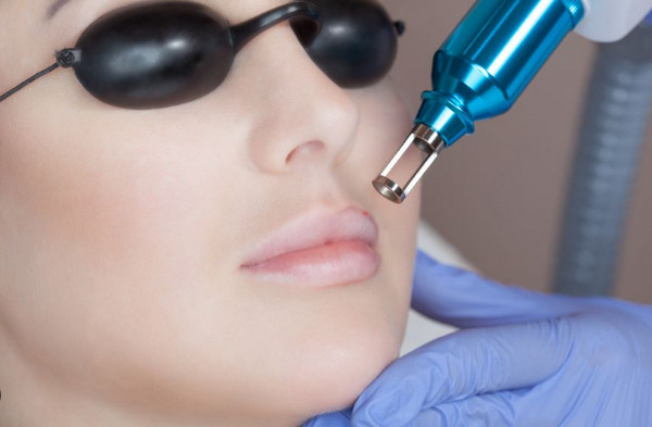 Xóa xăm môi tại nhà như thế nào? Cách nào hiệu quả nhất?