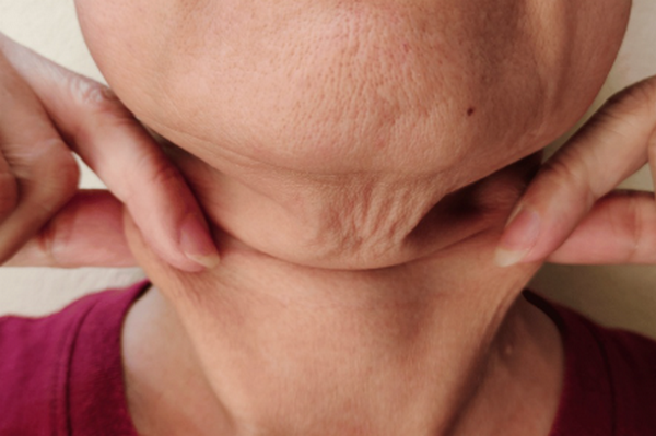 Da chảy xệ: Dấu hiệu, nguyên nhân và giải pháp cải thiện