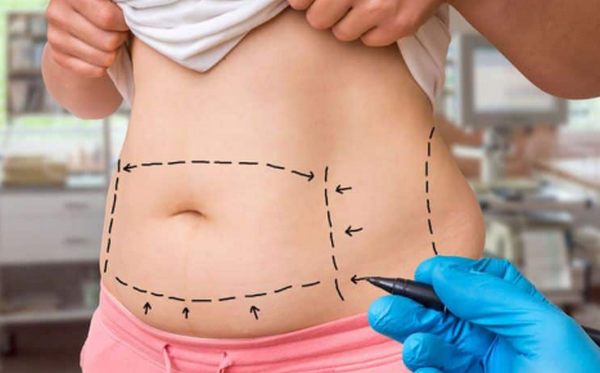 Da chảy xệ sau khi giảm cân do đâu, cách giúp da săn chắc hơn