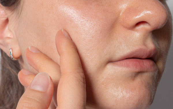 Hỏi đáp: Ăn nhiều dầu mỡ gây ảnh hưởng đến da như thế nào?