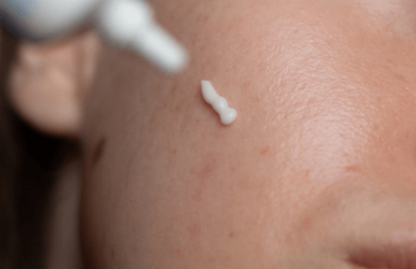 Bôi retinol bao lâu có hiệu quả? Bao lâu thì ngừng?