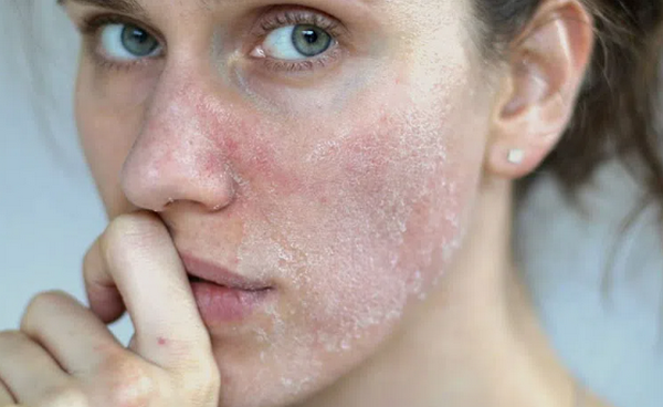 Nhận diện các loại da và cách chăm sóc từ A-Z