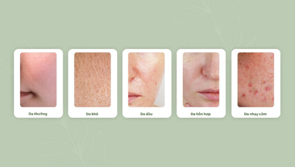 Nhận diện các loại da và cách chăm sóc từ A-Z