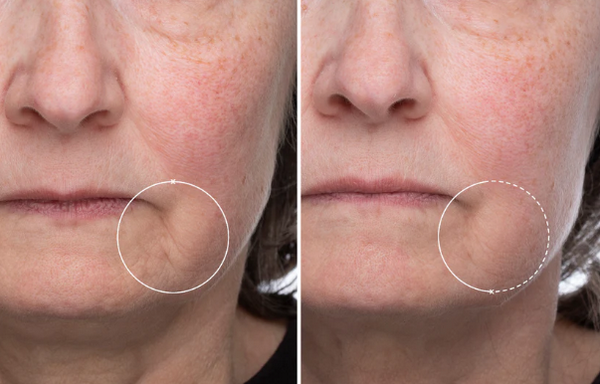 Retinol có làm mỏng da không, cách chăm sóc da khi dùng retinol