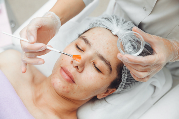 TCA 50% có nguy hiểm không? Sử dụng như thế nào an toàn?