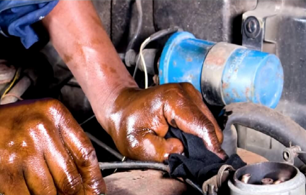 Bệnh sạm da nghề nghiệp là gì? Có điều trị được không?