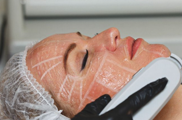 Biến chứng hifu có thể bạn chưa biết