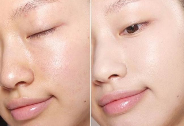 Cách dùng viên uống Retinol: Hiểu đúng để đẹp an toàn