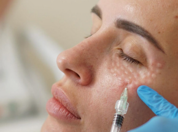 Cách làm cho da mặt căng mịn tự nhiên mà ai cũng cần biết