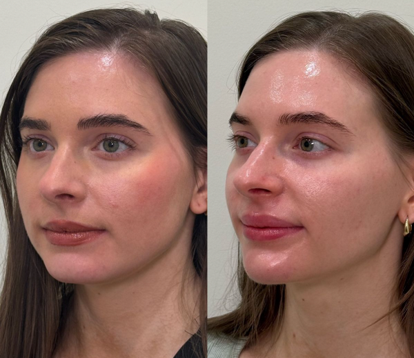 Cách làm cho da mặt căng mịn tự nhiên mà ai cũng cần biết