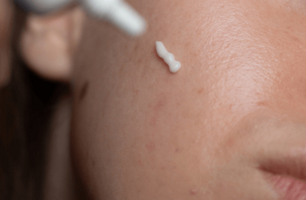 Retinol trị thâm được không? Cần lưu ý như thế nào?