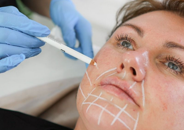 Tiêm BAP Jalupro và Profhilo cái nào tốt hơn