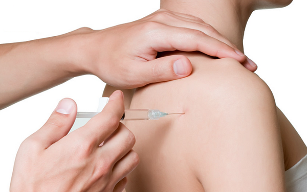 Tiêm botox vai là gì? Có nên tiêm thon gọn vai hay không?