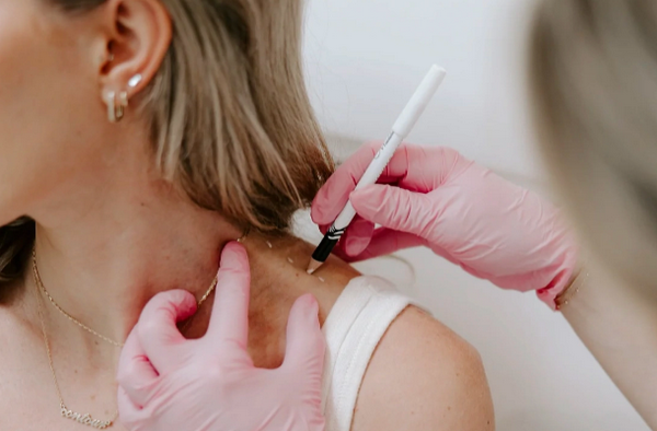 Tiêm botox vai là gì? Có nên tiêm thon gọn vai hay không?