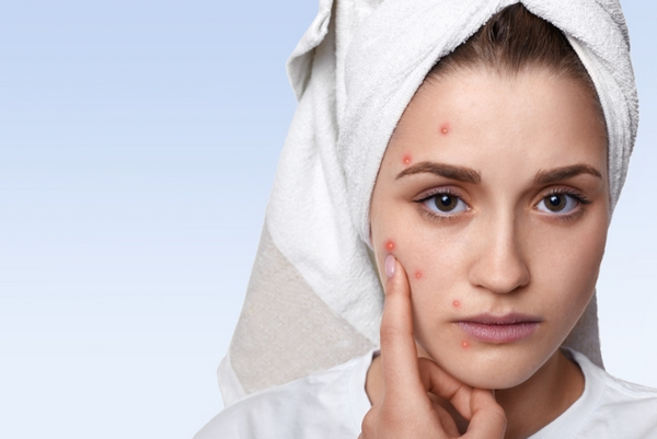 Hỏi đáp: Tretinoin bôi toàn mặt được không?