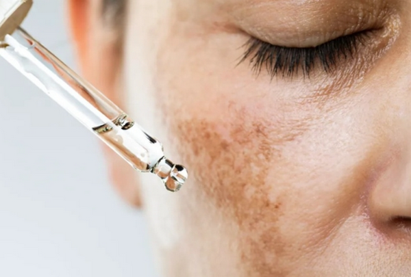 Tretinoin dùng chung với gì an toàn và hiệu quả