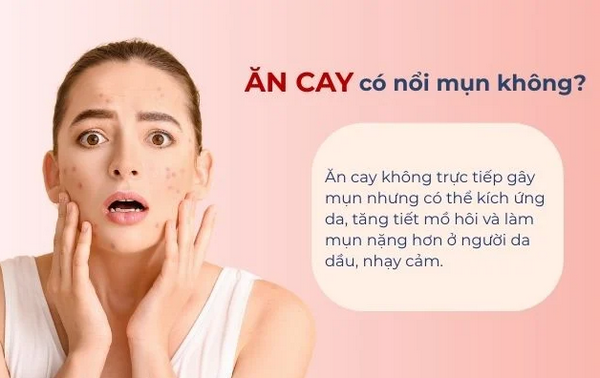 Hỏi đáp: Ăn cay nổi mụn có đúng không?