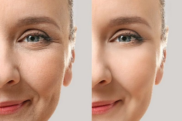 Jalupro classic: Thành phần, cơ chế, chỉ định và tác dụng