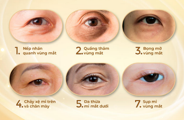 Jalupro tiêm mắt được không? Tác dụng và lưu ý an toàn